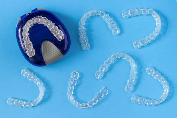 clear aligners